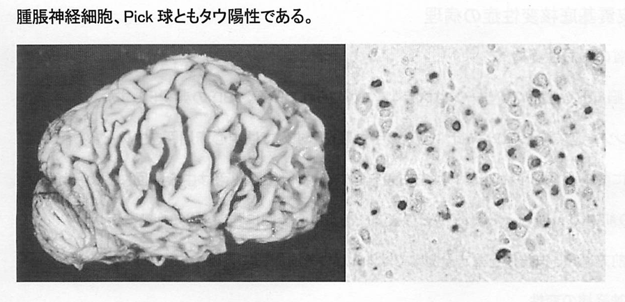 脳内のPic球画像